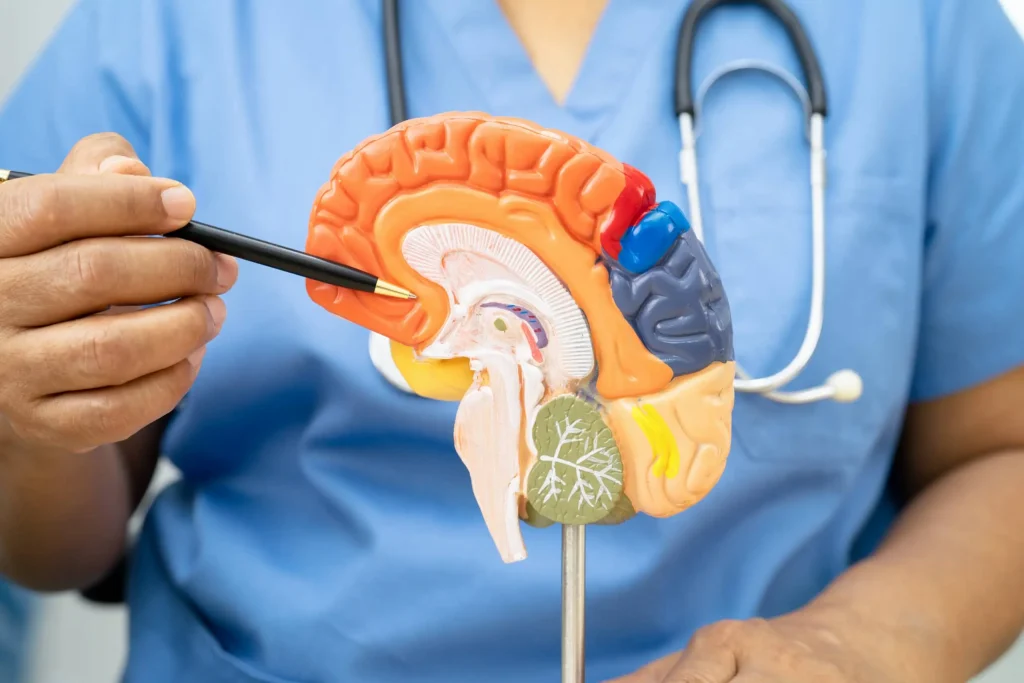 udar mózgu - model mózgu